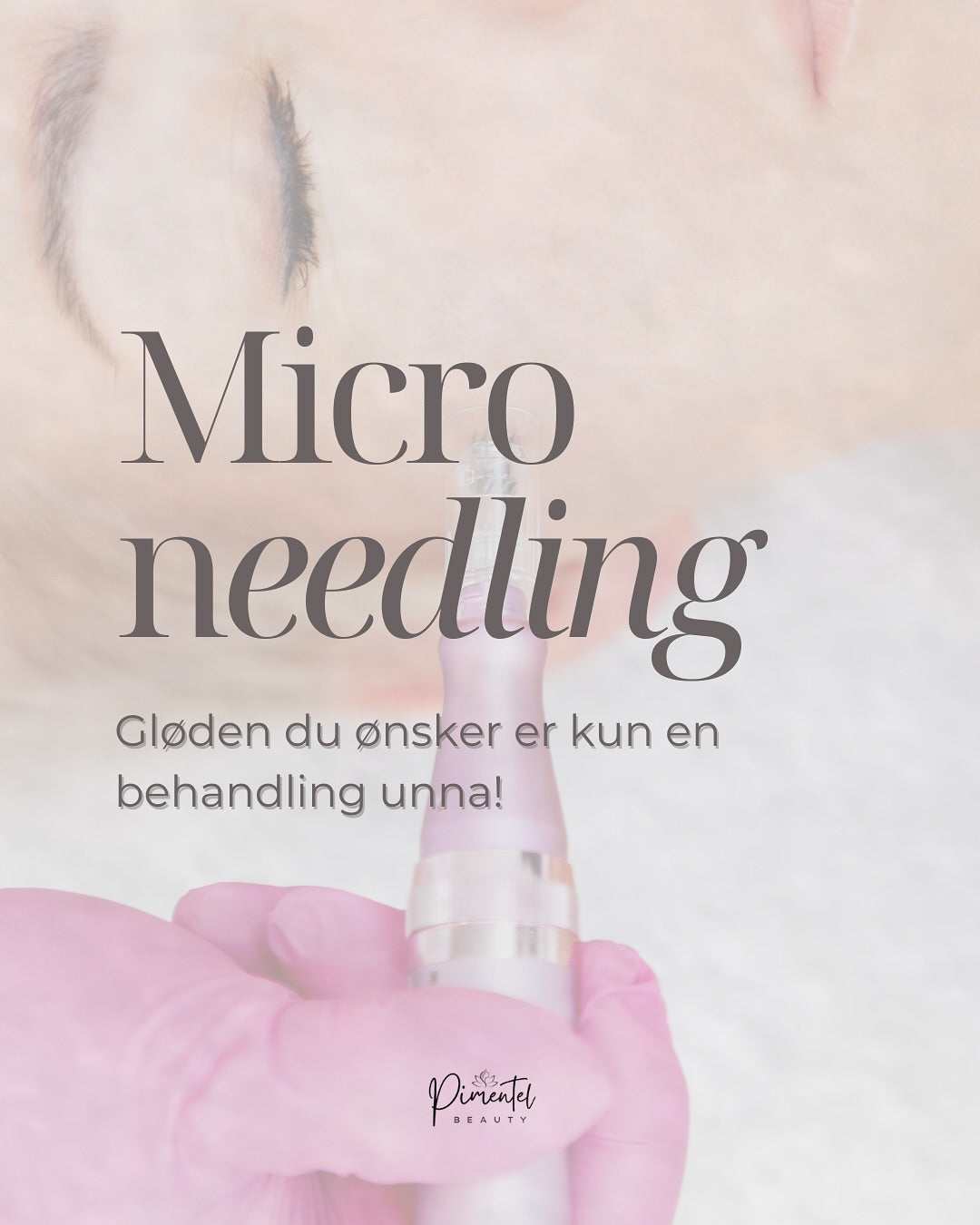 microneedling i Ski